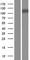MGEA5 Protein (Over-Expression Lysate Myc-DDK (Flag))
