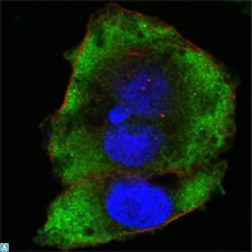 FER Antibody