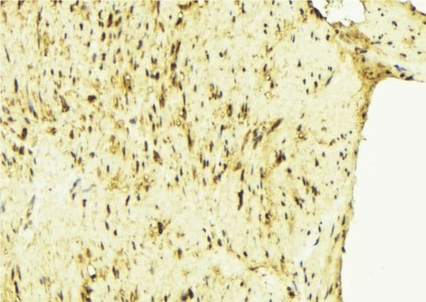 Polyclonal Rabbit anti-Human ZFYVE19 Antibody (IHC, IF, WB)