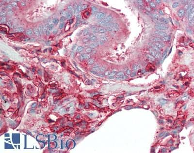 PathPlus™ B2M / Beta 2 Microglobulin Antibody
