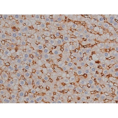 MAPT / Tau Antibody (phospho-Ser422)