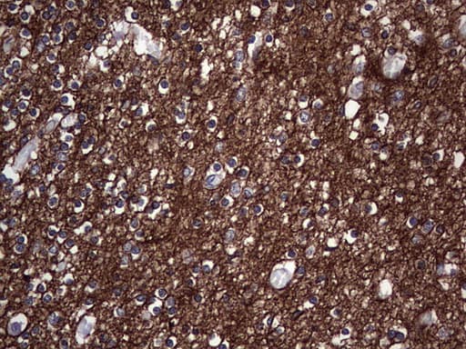 NCAM / CD56 Antibody (aa20-718, clone OTI1C7)