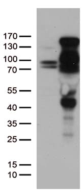 Monoclonal Mouse anti-Human PR / Progesterone Receptor Antibody (clone OTI29A3, aa1-298, WB)