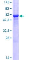 Human RPRD1A Protein (Recombinant GST)