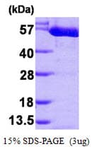 Human PKM / Pyruvate Kinase, Muscle Protein (Recombinant His)