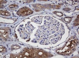 CRYAA / Alpha A Crystallin Antibody (clone OTI2C3)