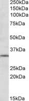 IHC-plus™ GRM2 / MGLUR2 Antibody (aa915-924)