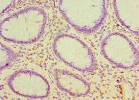 CDH16 / Cadherin 16 Antibody (aa19-230)