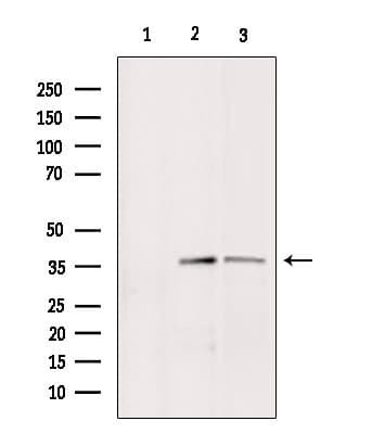 BNIP2 Antibody