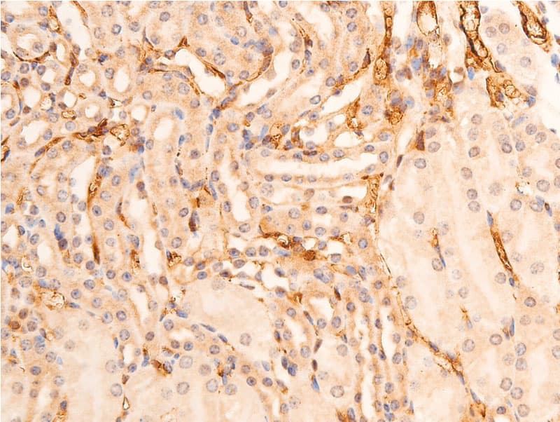 Polyclonal Rabbit anti-Human CHEK1 / CHK1 Antibody (phospho-Ser280, IHC, IF, WB)