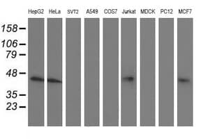 ALS2CR1 / NIF3L1 Antibody (clone OTI3E1)