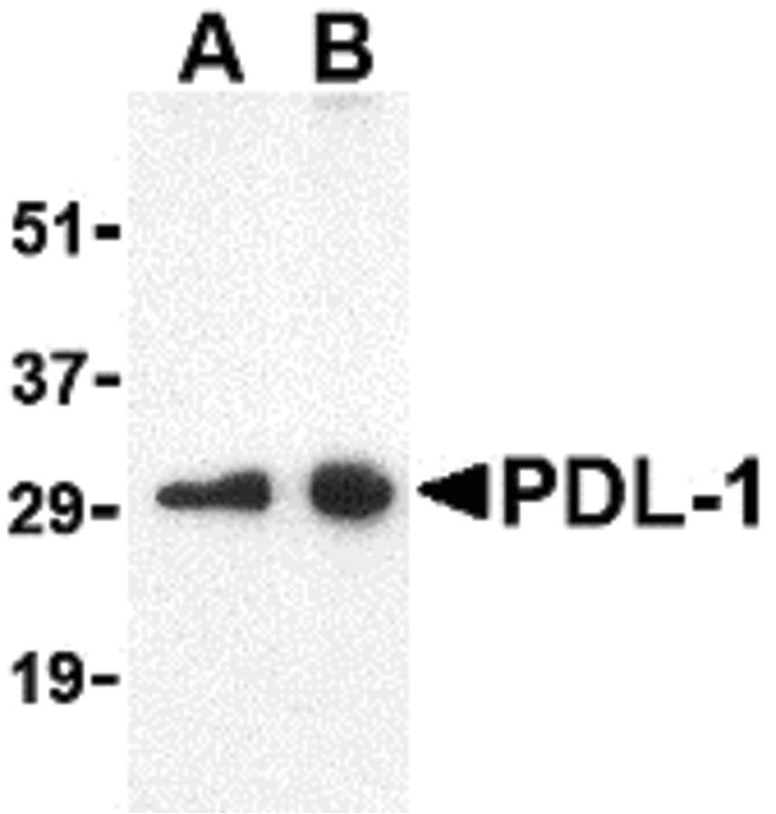 CD274 / B7-H1 / PD-L1 Antibody