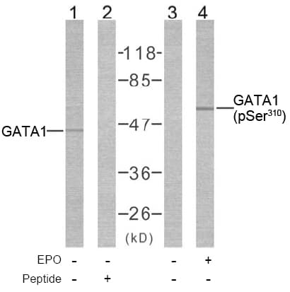 GATA1 Antibody (phospho-Ser310)