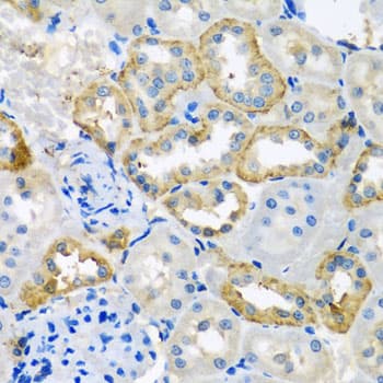 UQCR10 / UCRC Antibody