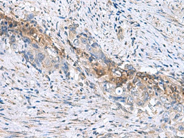 RNF208 Antibody