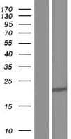 Human DDAH1 Protein (Over-Expression Lysate Myc-DDK (Flag))