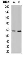 Polyclonal Rabbit anti-Human ESR2 / ER Beta Antibody (Internal, IF, WB)