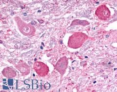 PathPlus™ Polyclonal Rabbit anti-Human GALR2 / Galanin Receptor 2 Antibody (Transmembrane Domain, IHC)