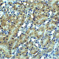 RIPK3 / RIP3 Antibody