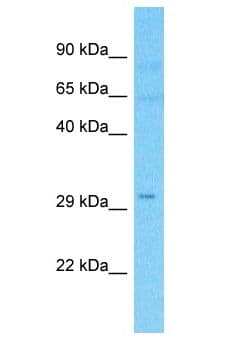 TCP11L2 Antibody (aa138-187)