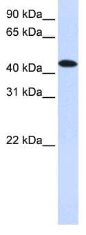 MKNK2 / MNK2 Antibody (aa36-85)