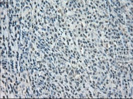 Monoclonal Mouse anti-Human BUB1B / BubR1 Antibody (clone OTI15E11, IHC, IF, WB)