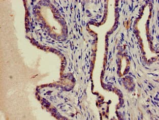 PIM1 / Pim-1 Antibody