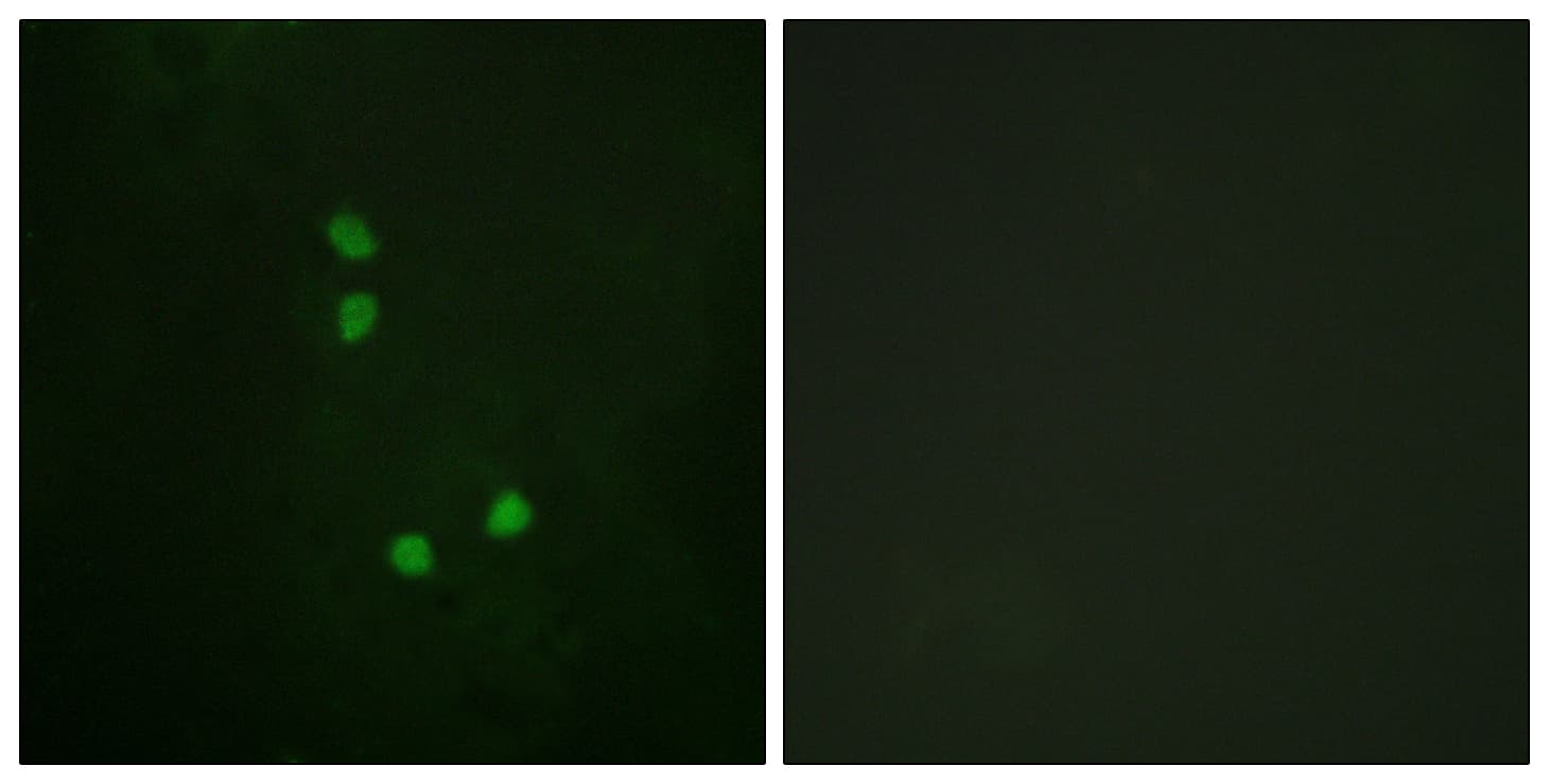 Polyclonal Rabbit anti-Human CCNE2 / Cyclin E2 Antibody (phospho-Thr392, IF)