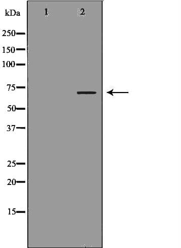 DBH/Dopamine Beta Hydroxylase Antibody