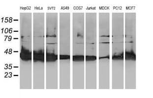 ALS2CR1 / NIF3L1 Antibody (clone OTI5A7, Carrier-free)