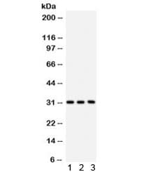 Polyclonal Rabbit anti-Human VDAC1 / PORIN Antibody (aa154-181, IHC, WB)