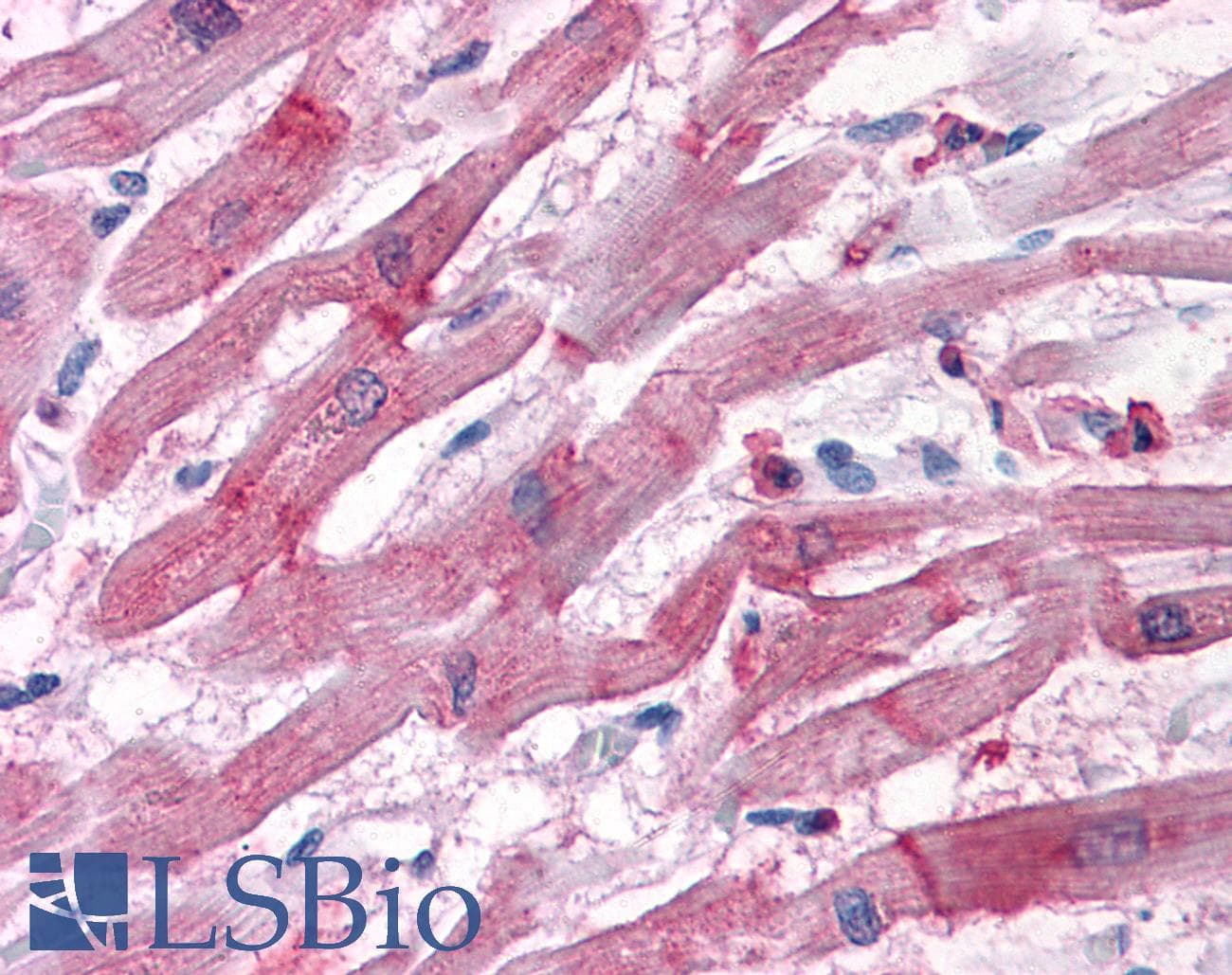 IHC-plus™ Polyclonal Goat anti-Human BAG3 / BAG-3 Antibody (aa563-575, IHC, WB)