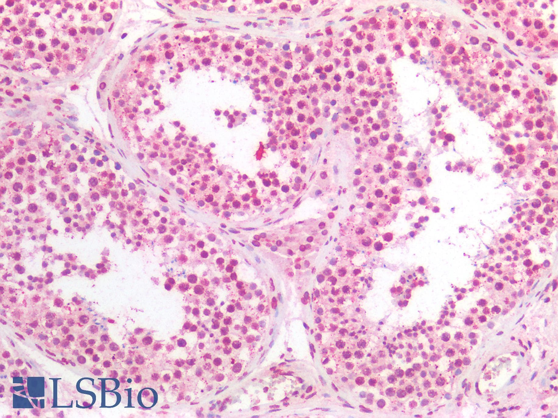 IHC-plus™ BRCA1 Antibody (aa1848-1863)