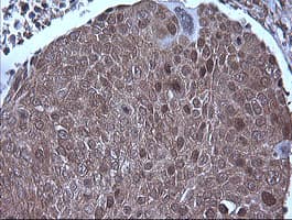 MAP2K1 / MKK1 / MEK1 Antibody (clone OTI3H3)