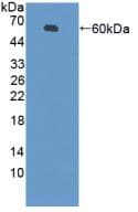 PZP Antibody (aa1224-1495)