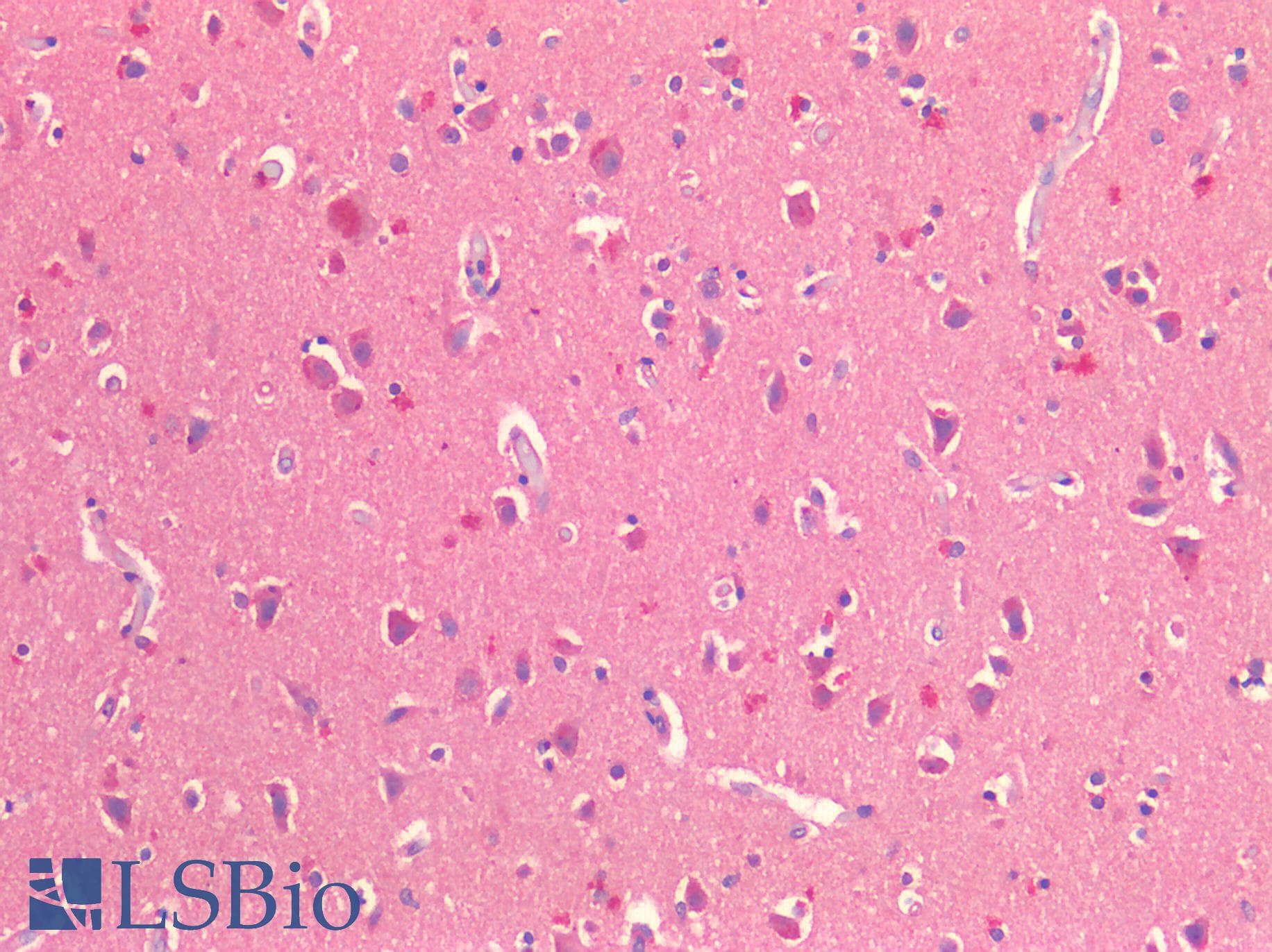 IHC-plus™ CX3CL1 / Fractalkine Antibody