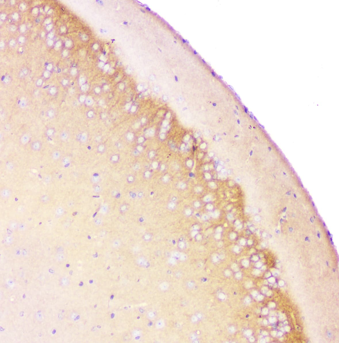APP / Beta Amyloid Precursor Antibody (aa672-713)
