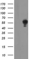 NONO / P54NRB Antibody (clone OTI2C9)
