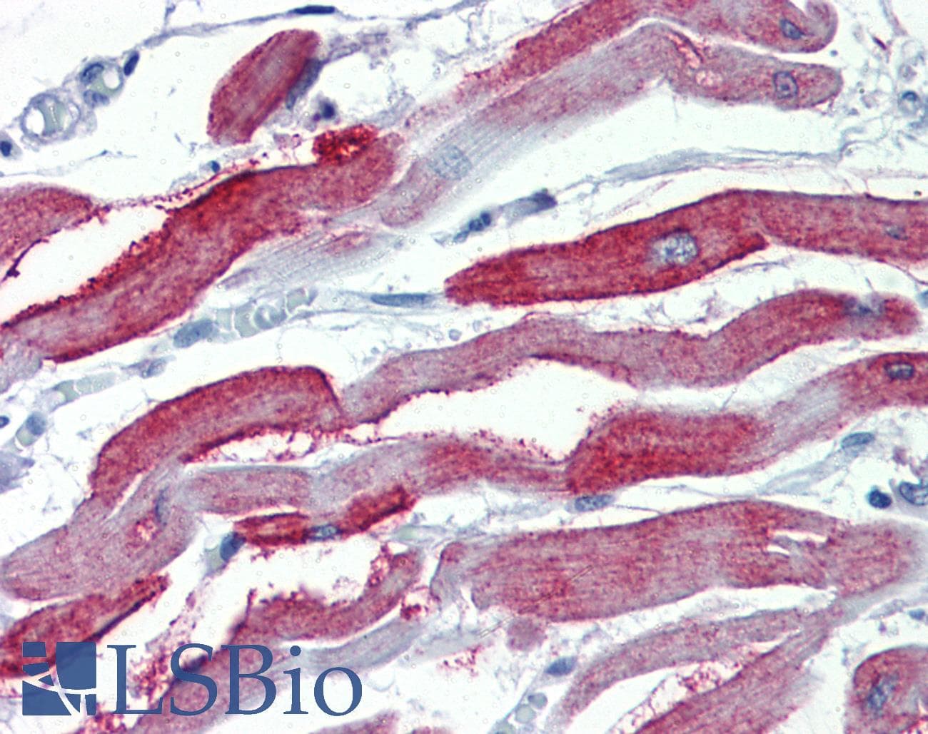IHC-plus™ Junctophilin 2 / JPH2 Antibody
