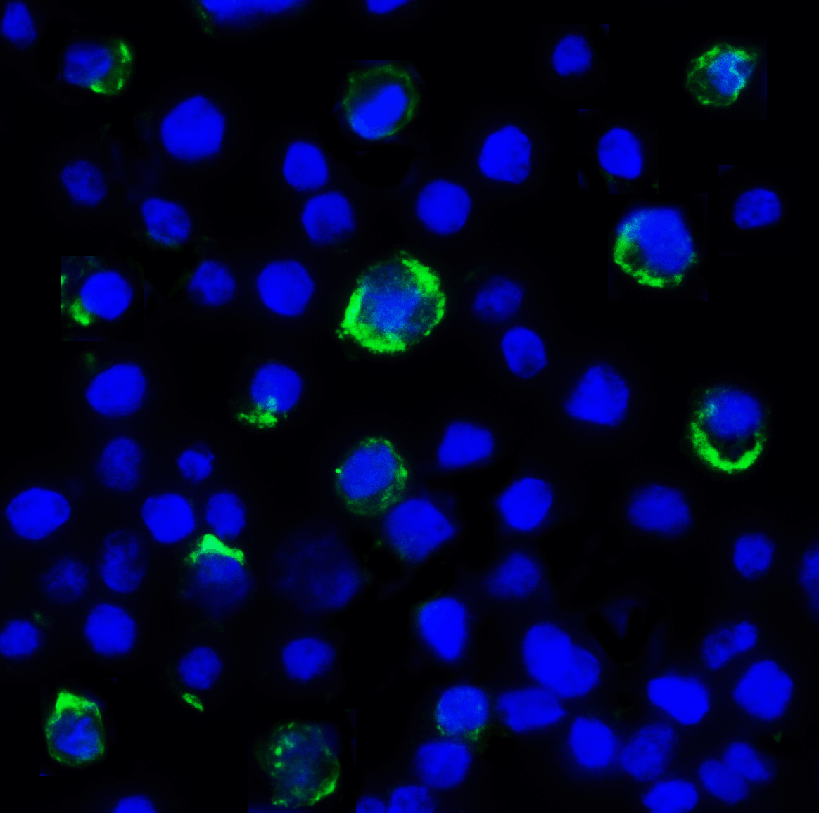 Monoclonal Mouse anti-Human LAG3 Antibody (clone 5F11, IHC, IF, WB)