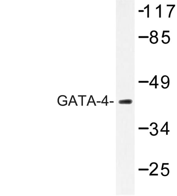 GATA4 Antibody (Arg306)