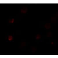 IHC-plus™ SLC35D3 / FRCL1 Antibody