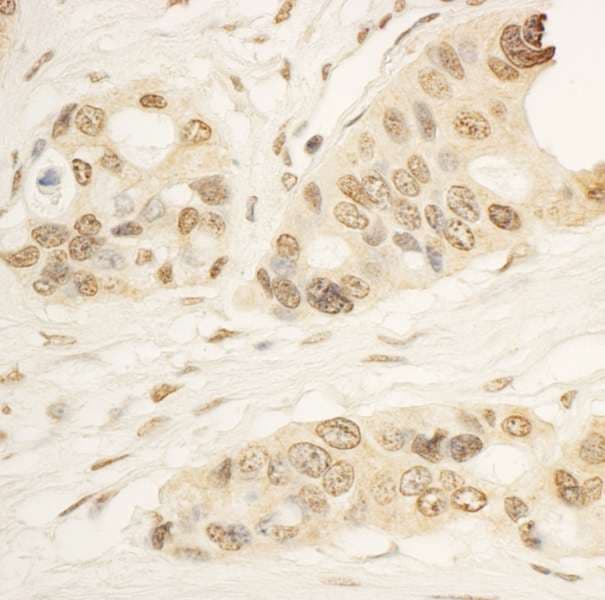 RAI1 Antibody (aa25-75)