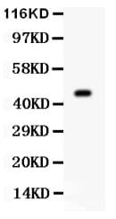 AURKA / Aurora-A Antibody (aa109-125)