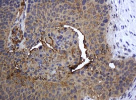 KRT5 / CK5 / Cytokeratin 5 Antibody (clone OTI4A7)