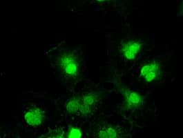 TYRO3 Antibody (clone OTI2D11)