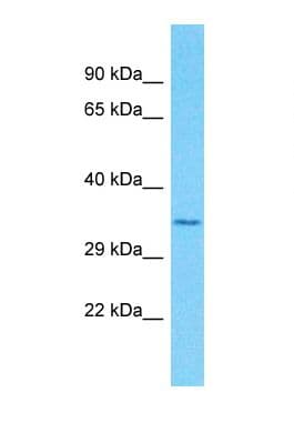 OR51F2 Antibody (aa224-273)