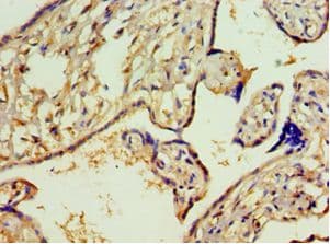 Polyclonal Rabbit anti-Human ACY1 / Aminoacylase 1 Antibody (aa1-408, IHC, WB)