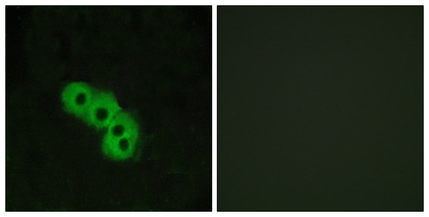 Niacin Receptor Antibody (aa285-334)