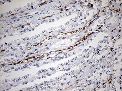FSCN1 / Fascin Antibody (clone OTI3D2)